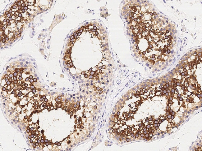 ART3 Antibody in Immunohistochemistry (Paraffin) (IHC (P))