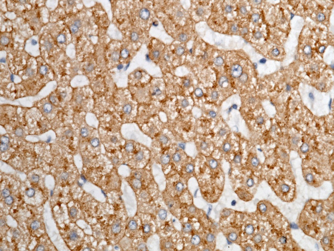 ASGR1 Antibody in Immunohistochemistry (Paraffin) (IHC (P))