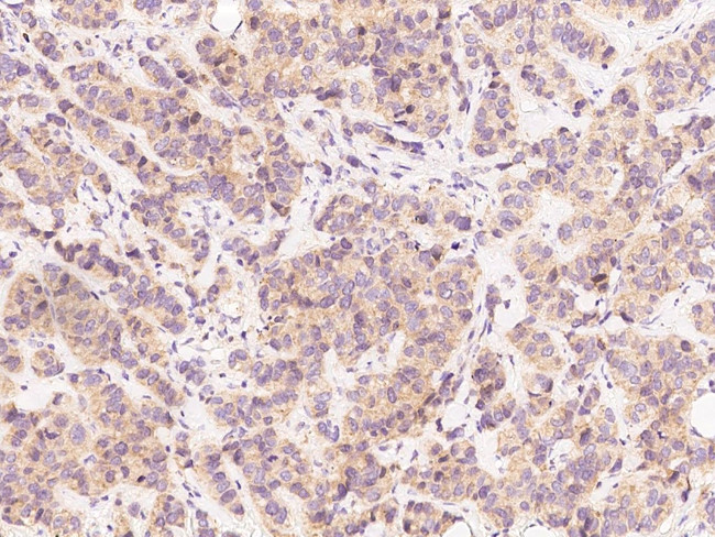 Beclin 1 Antibody in Immunohistochemistry (Paraffin) (IHC (P))