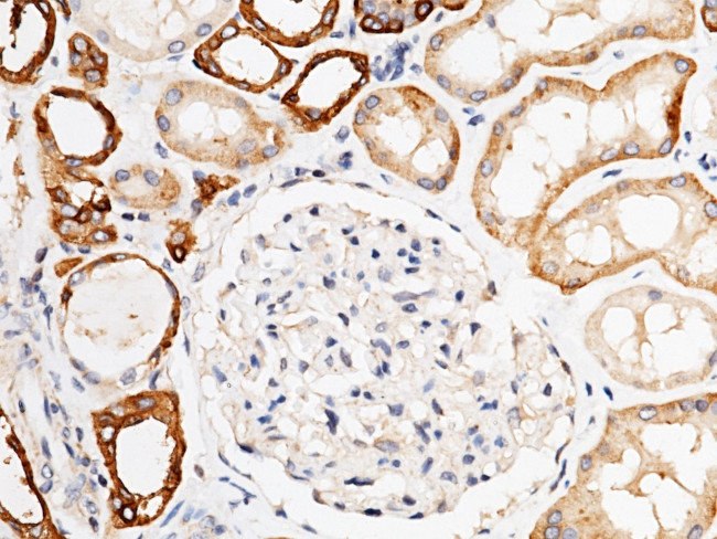 Carbonic Anhydrase XII Antibody in Immunohistochemistry (Paraffin) (IHC (P))