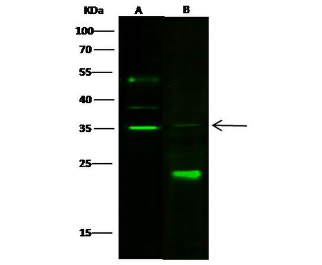 Carbonic Anhydrase VA Antibody in Western Blot (WB)