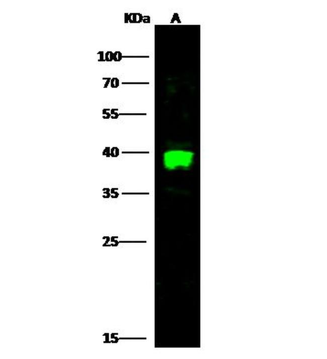 Carbonic Anhydrase VIII Antibody in Western Blot (WB)