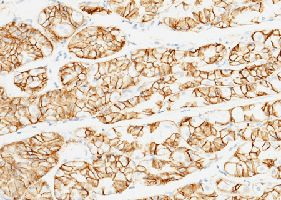 Carbonic Anhydrase IX Antibody in Immunohistochemistry (Paraffin) (IHC (P))
