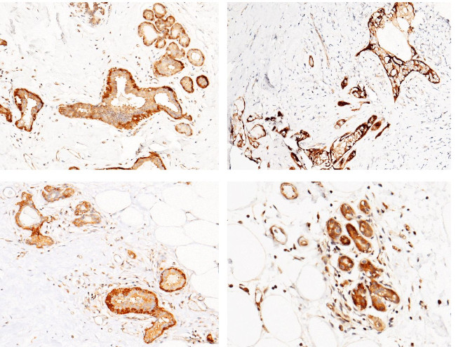 CALML3 Antibody in Immunohistochemistry (Paraffin) (IHC (P))