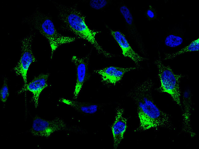 CaMKV Antibody in Immunocytochemistry (ICC/IF)