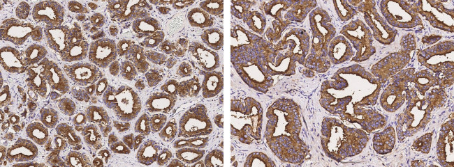 CD164 Antibody in Immunohistochemistry (Paraffin) (IHC (P))