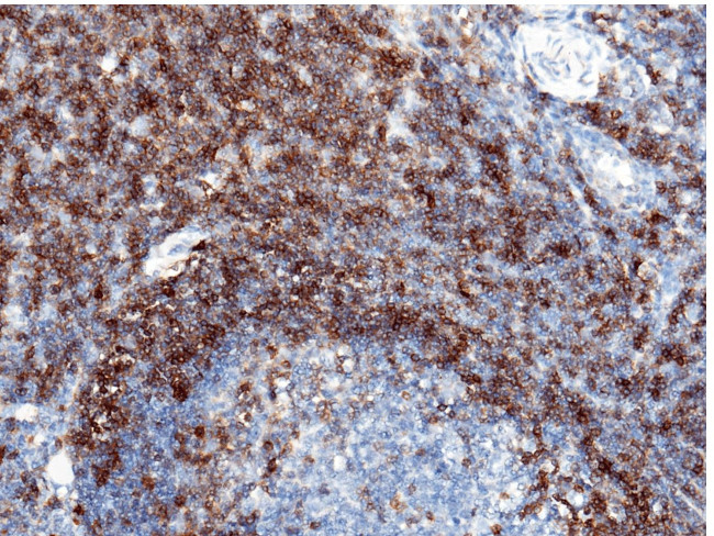 CD5 Antibody in Immunohistochemistry (Paraffin) (IHC (P))
