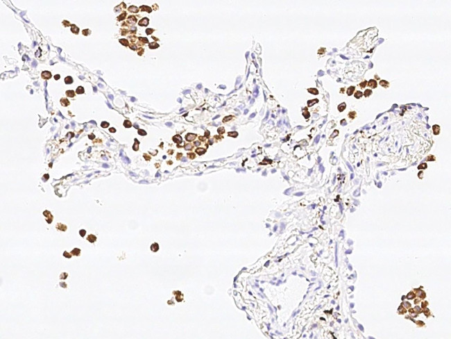 CD68 Antibody in Immunohistochemistry (Paraffin) (IHC (P))
