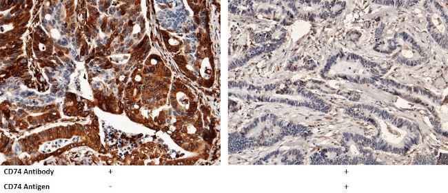 CD74 Antibody in Immunohistochemistry (Paraffin) (IHC (P))