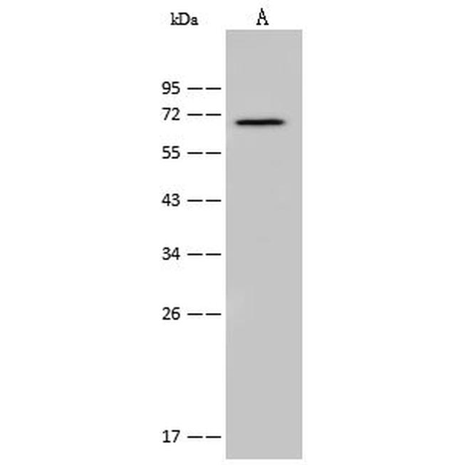 CDC25B Antibody in Western Blot (WB)