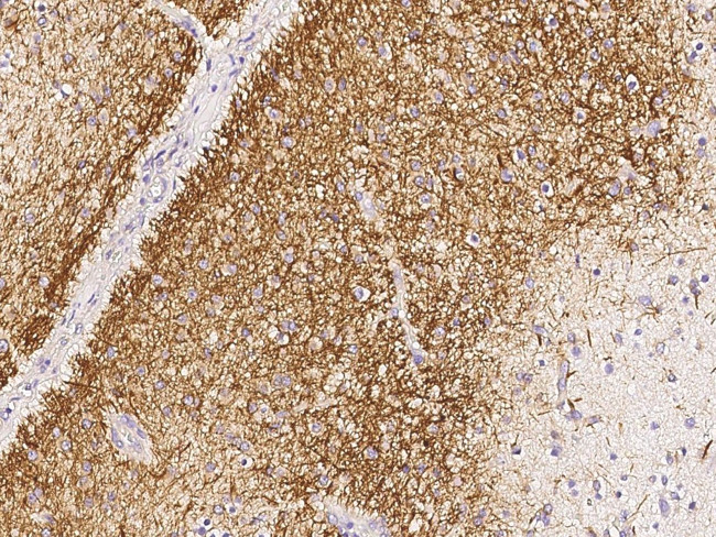 CDC37 Antibody in Immunohistochemistry (Paraffin) (IHC (P))