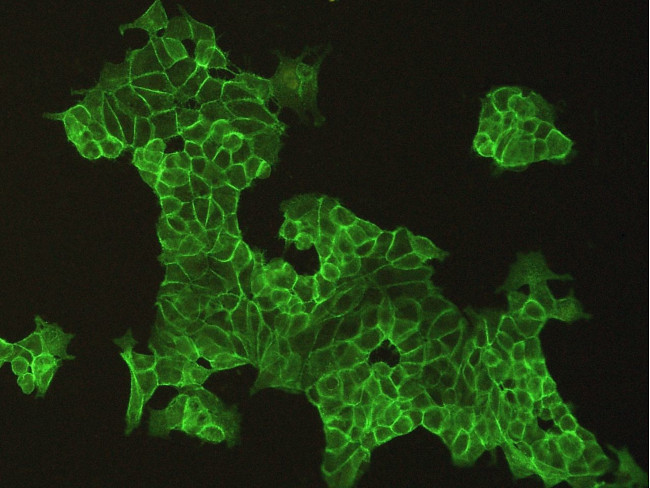 E-cadherin Antibody in Immunocytochemistry (ICC/IF)