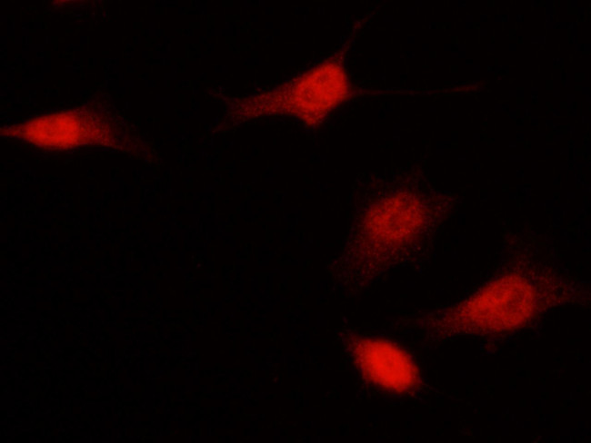p14ARF Antibody in Immunocytochemistry (ICC/IF)