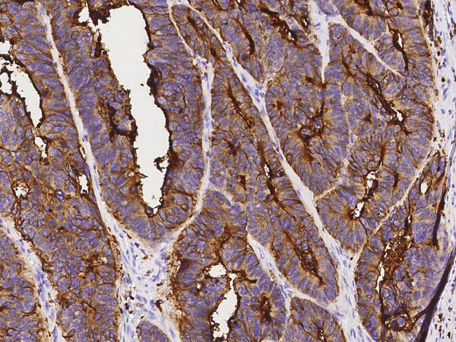 CEACAM3 Antibody in Immunohistochemistry (Paraffin) (IHC (P))