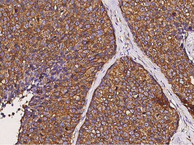 Cofilin Antibody in Immunohistochemistry (Paraffin) (IHC (P))