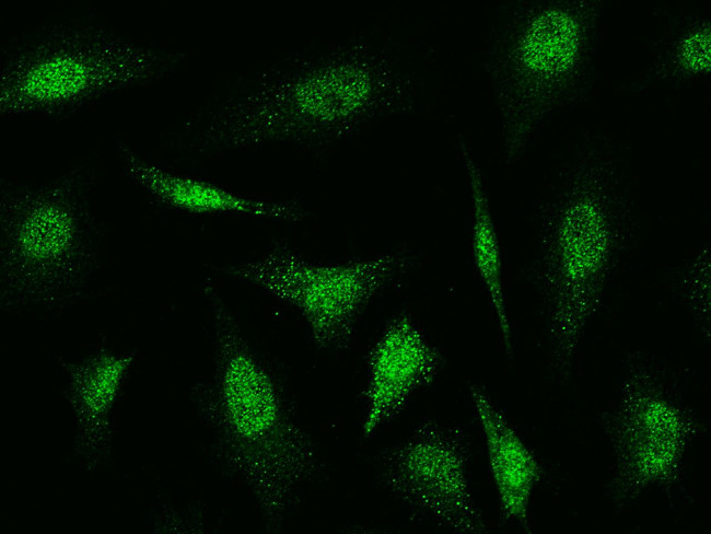 Cofilin 2 Antibody in Immunocytochemistry (ICC/IF)
