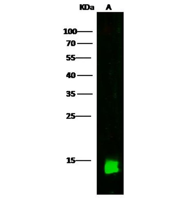 CRABP2 Antibody in Western Blot (WB)
