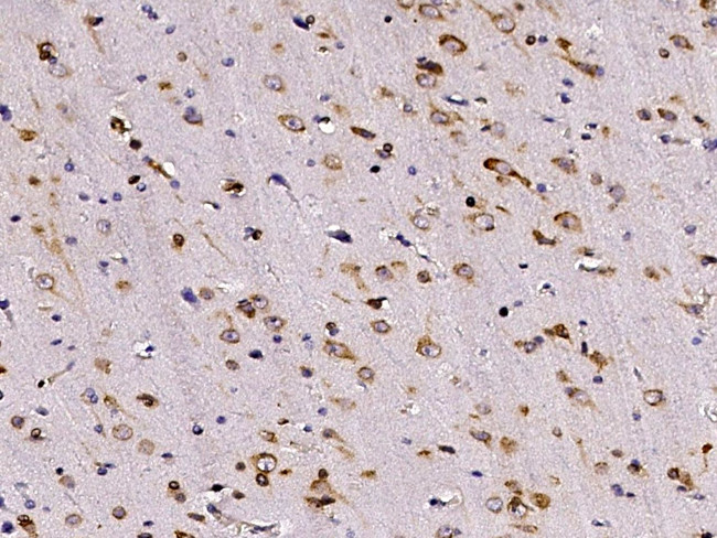CRELD1 Antibody in Immunohistochemistry (Paraffin) (IHC (P))