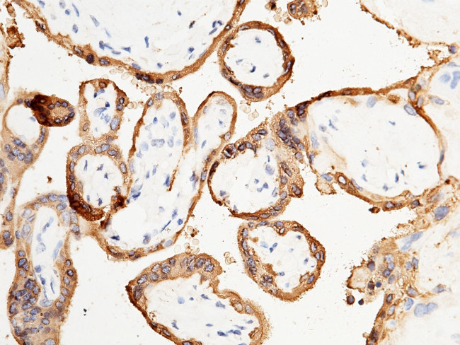 CSH1 Antibody in Immunohistochemistry (Paraffin) (IHC (P))