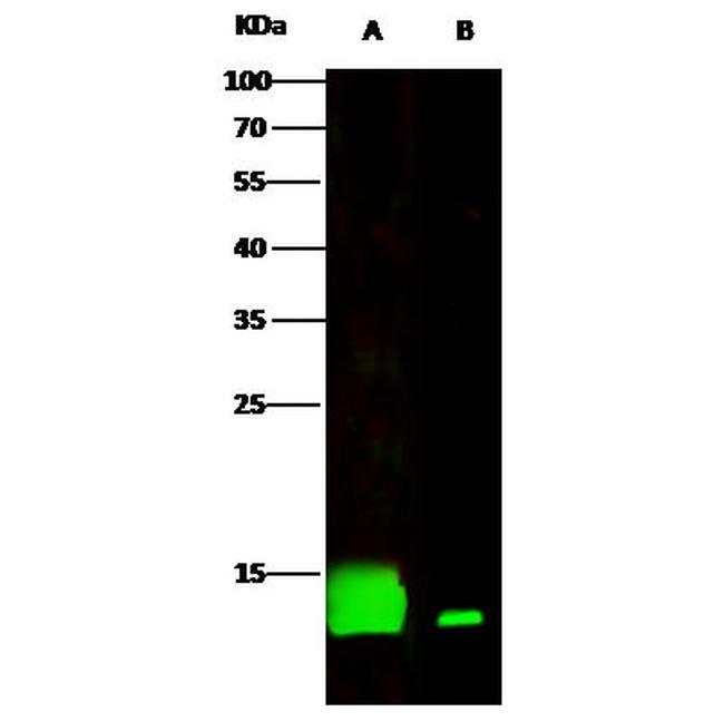 Cystatin B Antibody in Western Blot (WB)