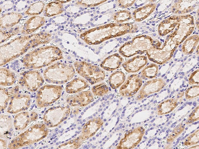 Cathepsin B Antibody in Immunohistochemistry (Paraffin) (IHC (P))