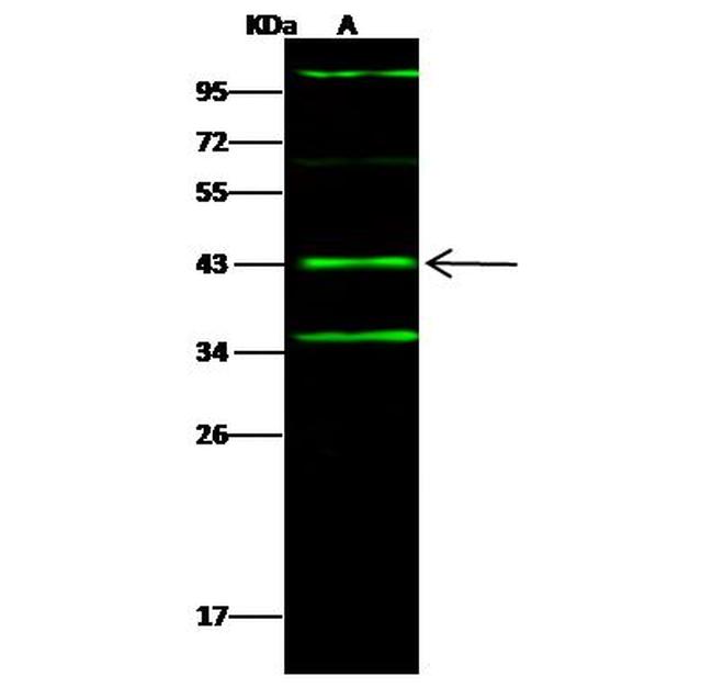 Cathepsin V Antibody in Western Blot (WB)