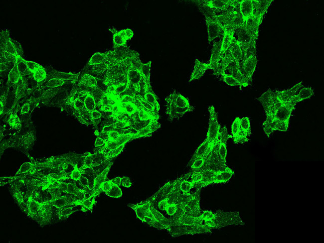CAR Antibody in Immunocytochemistry (ICC/IF)