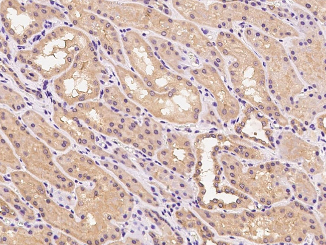 CYYR1 Antibody in Immunohistochemistry (Paraffin) (IHC (P))