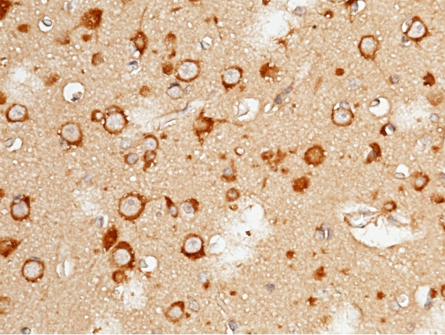 Doublecortin Antibody in Immunohistochemistry (Paraffin) (IHC (P))