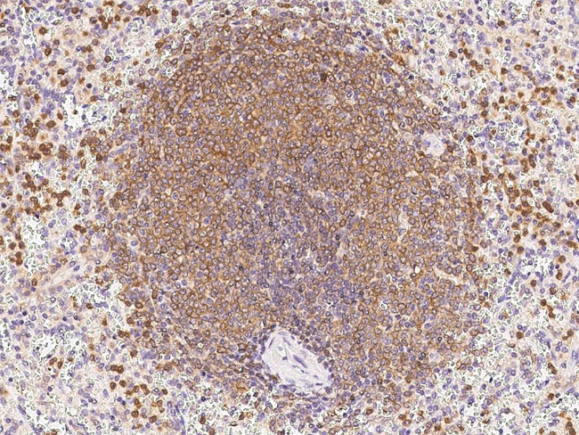 DOK3 Antibody in Immunohistochemistry (Paraffin) (IHC (P))