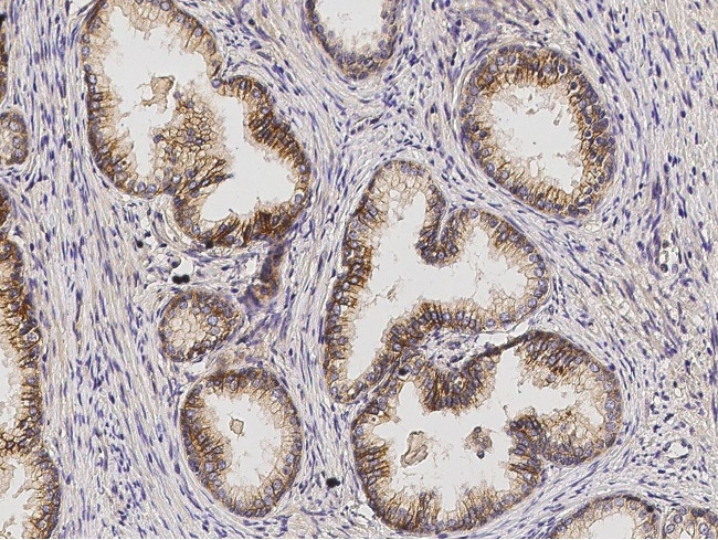 Desmoglein 2 Antibody in Immunohistochemistry (Paraffin) (IHC (P))