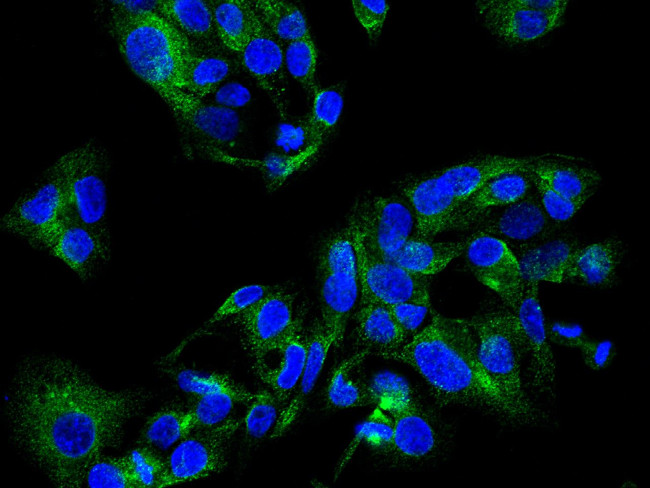 ECE1 Antibody in Immunocytochemistry (ICC/IF)