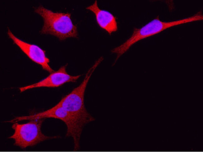 eIF5A Antibody in Immunocytochemistry (ICC/IF)