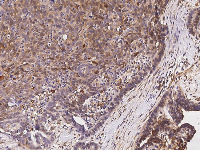 eIF5A2 Antibody in Immunohistochemistry (Paraffin) (IHC (P))