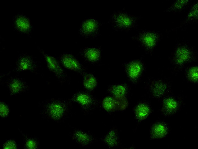 ELF3 Antibody in Immunocytochemistry (ICC/IF)