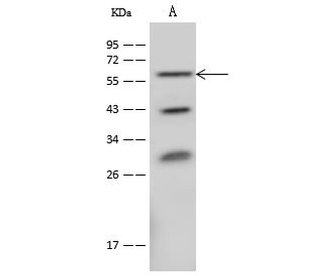CD39 Antibody in Western Blot (WB)
