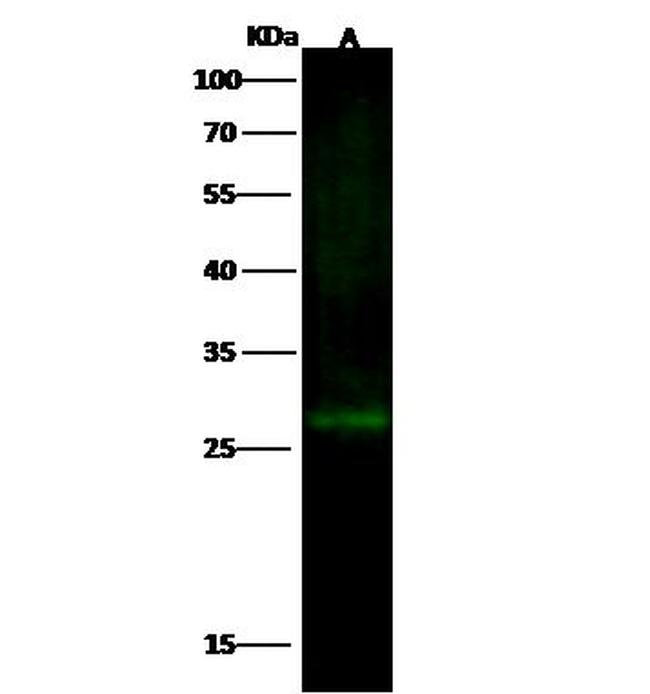 UCC1 Antibody in Western Blot (WB)