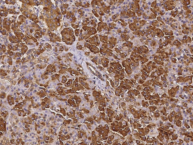 EphB6 Antibody in Immunohistochemistry (Paraffin) (IHC (P))