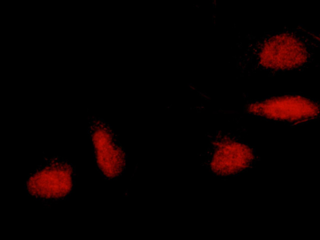 ERCC8 Antibody in Immunocytochemistry (ICC/IF)