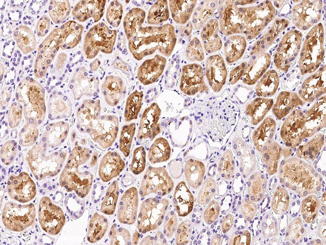 Factor XII Antibody in Immunohistochemistry (Paraffin) (IHC (P))