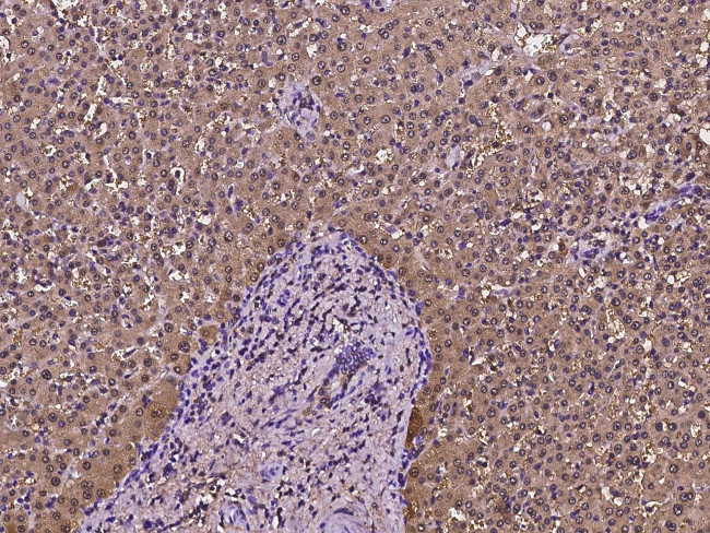 FABP1 Antibody in Immunohistochemistry (Paraffin) (IHC (P))