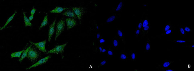 FANCC Antibody in Immunocytochemistry (ICC/IF)