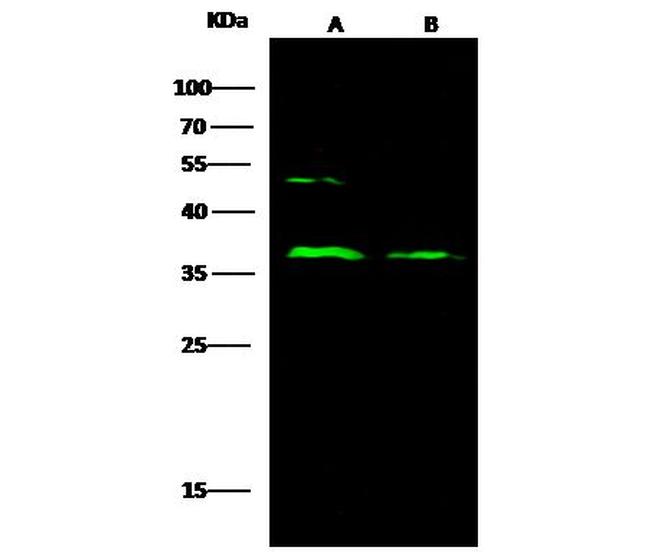CD23 Antibody in Western Blot (WB)