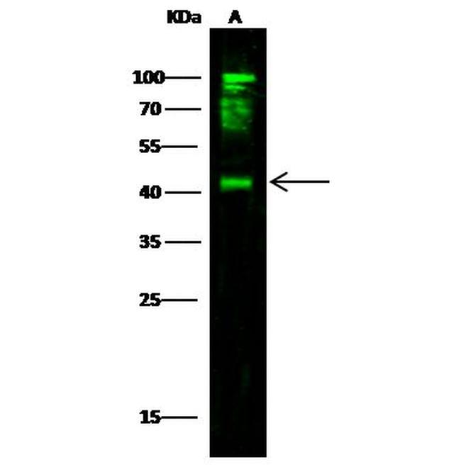 CD64 Antibody in Western Blot (WB)