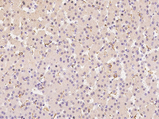CD16 Antibody in Immunohistochemistry (Paraffin) (IHC (P))