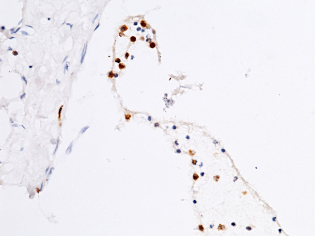 FCN1 Antibody in Immunohistochemistry (Paraffin) (IHC (P))