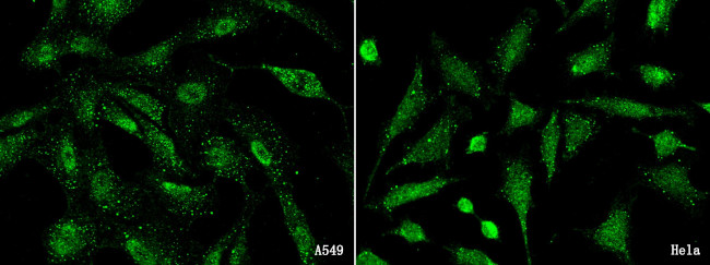 FES Antibody in Immunocytochemistry (ICC/IF)