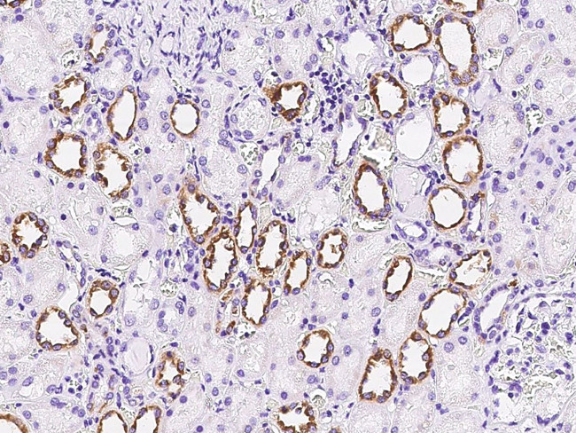 FGD2 Antibody in Immunohistochemistry (Paraffin) (IHC (P))