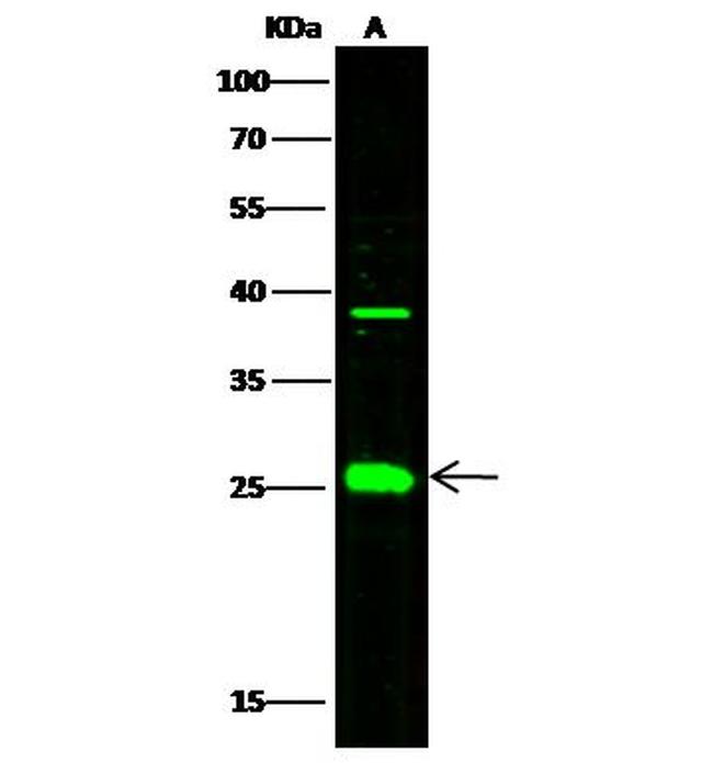 FKBP7 Antibody in Western Blot (WB)