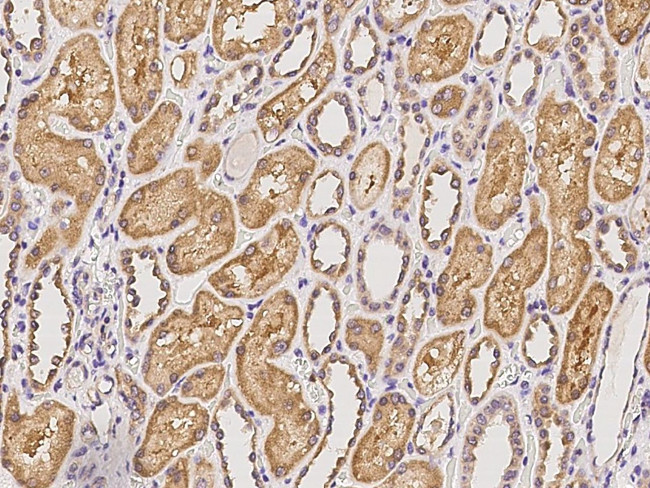 FRMPD2 Antibody in Immunohistochemistry (Paraffin) (IHC (P))